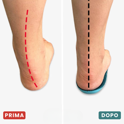 RinovaX™ – Soletta Ortopedica Anti-Dolore