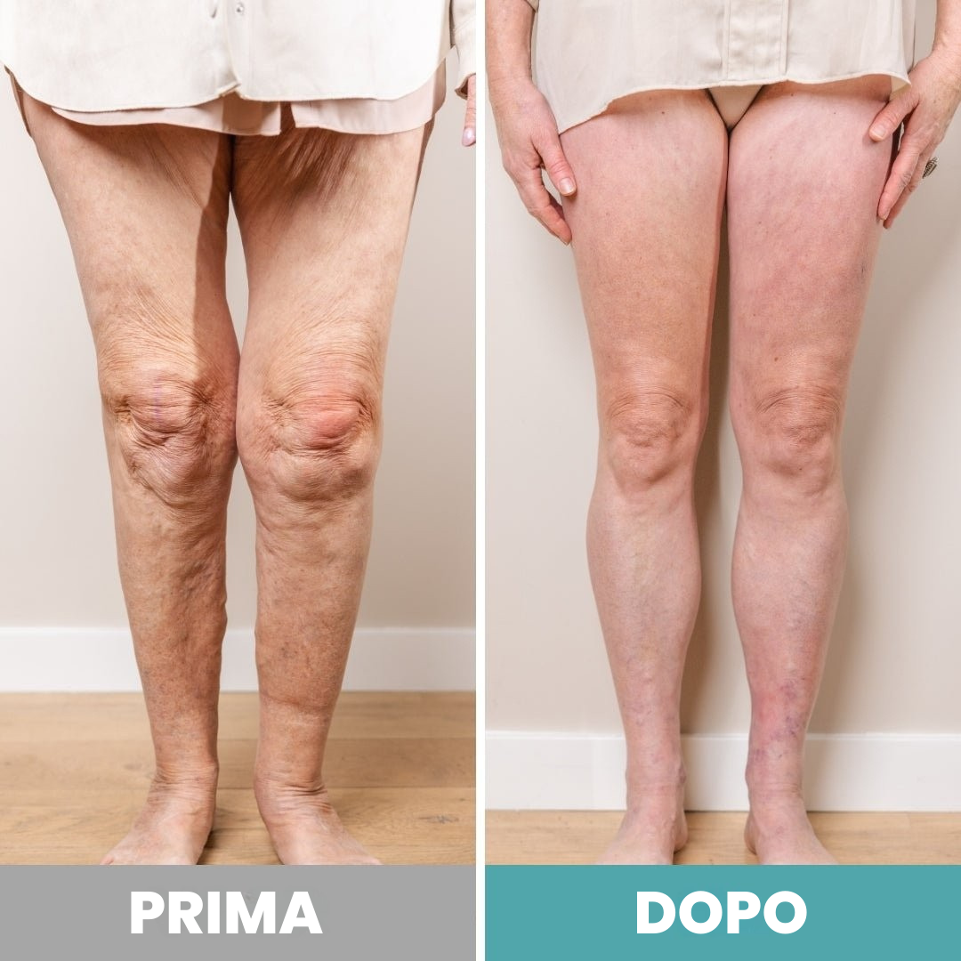 RinovaX™ – Massaggiatore Plantare Elettrico