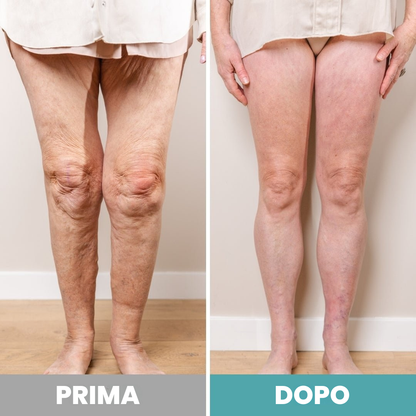 RinovaX™ – Massaggiatore Plantare Elettrico