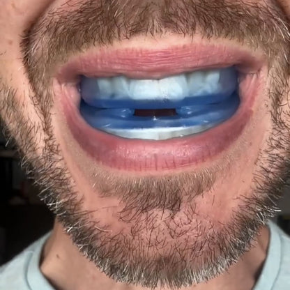 RinovaX™ – Bite anti-russamento silenzioso universale